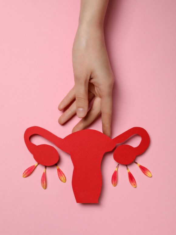 Мифы про кисты яичников